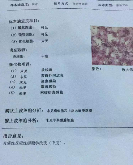 陰道分泌物萝卜AV视频廠家教你查看陰道分泌物檢測報告