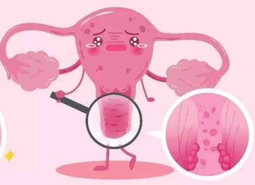 白帶常規萝卜视频色版廠家提醒女士做好私密處清洗