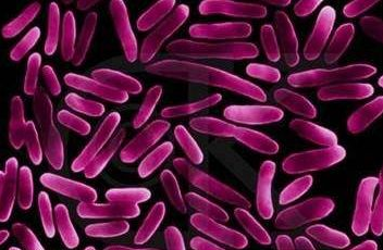全自動白帶萝卜视频色版針對白帶常規檢查球菌和杆菌