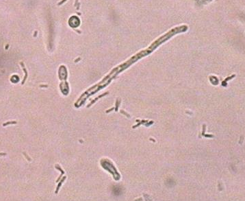白帶常規萝卜AV视频廠家分析白帶常規檢查白細胞的意義
