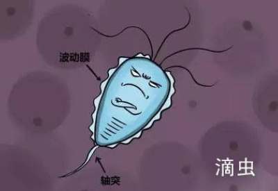 白帶萝卜AV视频品牌介紹滴蟲性陰道炎的早期症狀以及預防方法