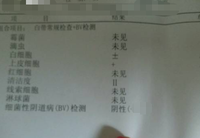 全自動白帶萝卜视频色版分享如何看懂白帶常規檢測報告單