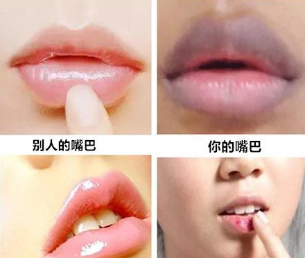 山東青島全自動陰道分泌物綜合萝卜AV视频器能夠檢測陰道子宮的健康狀況！